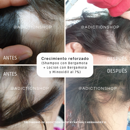 KIT PLUS* - CRECIMIENTO REFORZADO + ANTICAÍDA