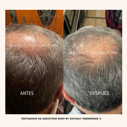 Loción con Bergamota y Minoxidil al 7%