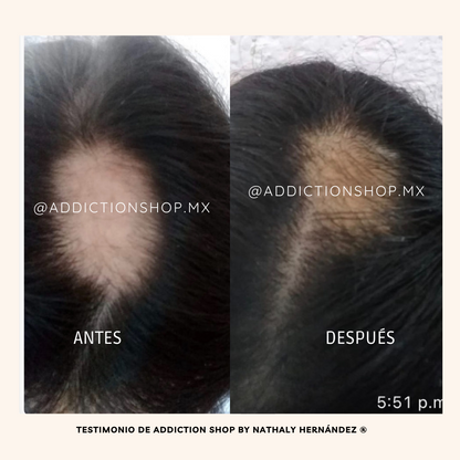 Loción con Bergamota y Minoxidil al 7%